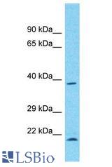 WDR21A / DCAF4 antibody Western Blot of COLO205. Antibody dilution: 1 ug/ml.