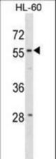 WDR21A Antibody western blot of HL-60 cell line lysates (35 ug/lane). The WDR21A antibody detected the WDR21A protein (arrow).