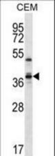 WDR25 Antibody western blot of CEM cell line lysates (35 ug/lane). The WDR25 antibody detected the WDR25 protein (arrow).