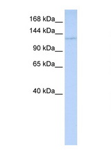WDR3 antibody LS-C102824 Western blot of HeLa Cell lysate. Antibody concentration 1 ug/ml.