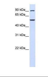 Fetal brain lysate. Antibody concentration: 1.0 ug/ml. Gel concentration: 12%.