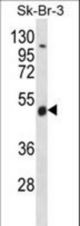 WDR34 Antibody western blot of SK-BR-3 cell line lysates (35 ug/lane). The WDR34 antibody detected the WDR34 protein (arrow).
