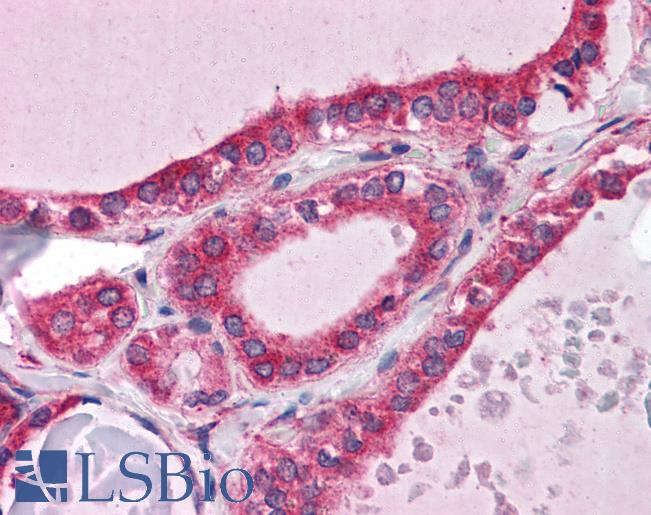 Anti-WDR35 antibody IHC of human thyroid. Immunohistochemistry of formalin-fixed, paraffin-embedded tissue after heat-induced antigen retrieval. Antibody LS-B4727 concentration 5 ug/ml.