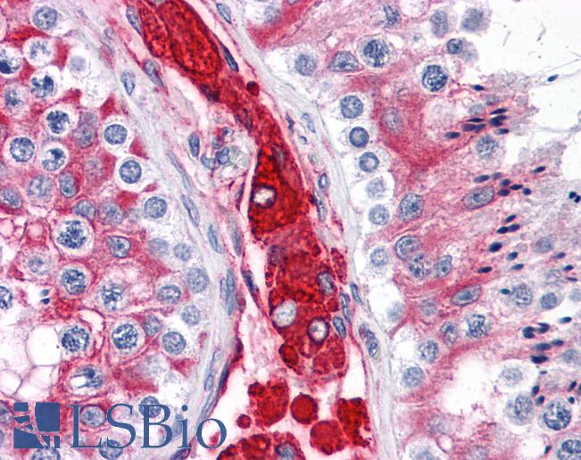 Anti-WDR35 antibody IHC of human testis. Immunohistochemistry of formalin-fixed, paraffin-embedded tissue after heat-induced antigen retrieval. Antibody LS-B4727 concentration 5 ug/ml.