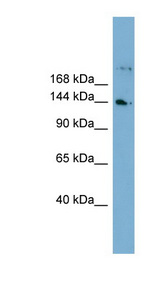 WDR35 antibody LS-C112066 Western blot of Fetal Lung lysate.