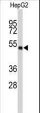 Western blot of WDR37 Antibody in HepG2 cell line lysates (35 ug/lane). WDR37 (arrow) was detected using the purified antibody.