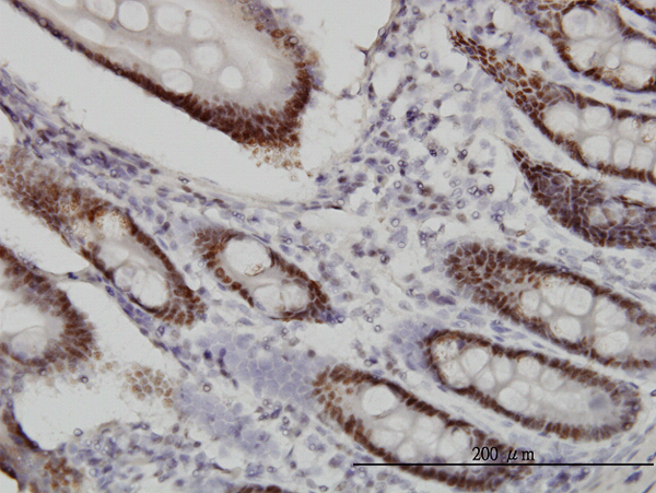 Immunoperoxidase of monoclonal antibody to WDR4 on formalin-fixed paraffin-embedded human small Intestine. [antibody concentration 1 ug/ml]