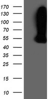 HEK293T cells were transfected with the pCMV6-ENTRY control (Left lane) or pCMV6-ENTRY WDR4 (Right lane) cDNA for 48 hrs and lysed. Equivalent amounts of cell lysates (5 ug per lane) were separated by SDS-PAGE and immunoblotted with anti-WDR4.