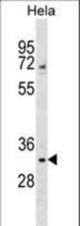 WDR4 Antibody western blot of HeLa cell line lysates (35 ug/lane). The WDR4 antibody detected the WDR4 protein (arrow).
