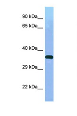 WDR41 antibody LS-C146363 Western blot of Small Intestine lysate. Antibody concentration 1 ug/ml.
