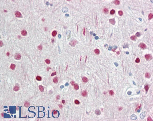 Anti-WDR5 antibody IHC staining of human brain, cortex. Immunohistochemistry of formalin-fixed, paraffin-embedded tissue after heat-induced antigen retrieval.