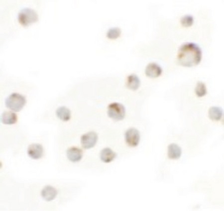 Immunocytochemistry of WDR5 in 293 cells with WDR5 antibody at 5 ug/ml.