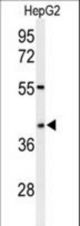 Western blot of WDR82 Antibody in HepG2 cell line lysates (35 ug/lane). WDR82 (arrow) was detected using the purified antibody.
