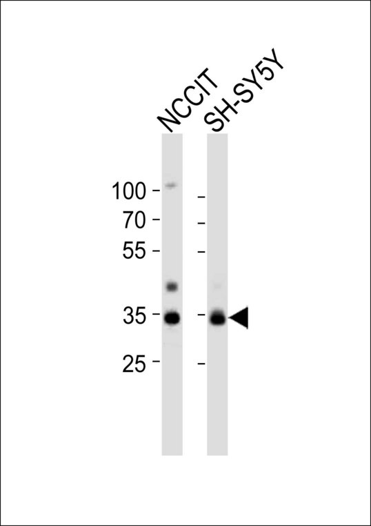 Western blot of lysates from NCCIT, SH-SY5Y cell line (from left to right) with WDR82 Antibody. Antibody was diluted at 1:1000 at each lane. A goat anti-rabbit IgG H&L (HRP) at 1:10000 dilution was used as the secondary antibody. Lysates at 20 ug per lane.