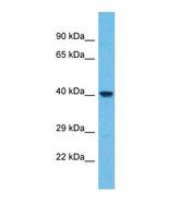 Western blot of Human HeLa. WDR86 antibody dilution 1.0 ug/ml.