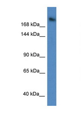 WDR87 antibody LS-C145607 Western blot of A549 Cell lysate. Antibody concentration 1 ug/ml.