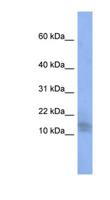 BRWD1 / WDR9 antibody LS-C110626 Western blot of PANC1 cell lysate.