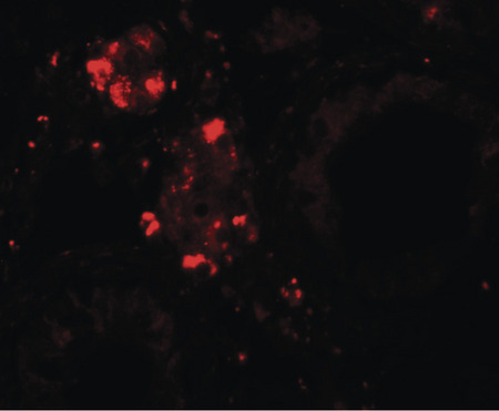 Immunofluorescence of WDR92 in human testis tissue with WDR92 antibody at 20 ug/ml.
