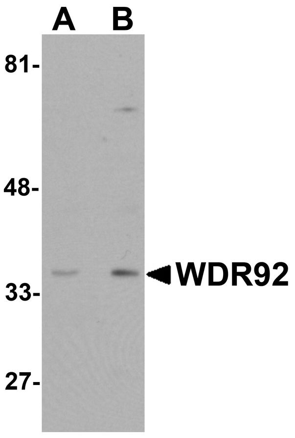 Western blot analysis of WDR92 in human kidney tissue lysate with WDR92 antibody at (A) 1 and (B) 2 ug/ml.