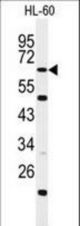 Western blot of WDTC1 Antibody in HL-60 cell line lysates (35 ug/lane). WDTC1 (arrow) was detected using the purified antibody.
