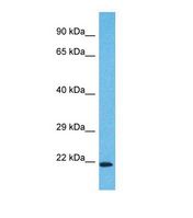 Western blot of Human HepG2. WDYHV1 antibody dilution 1.0 ug/ml.