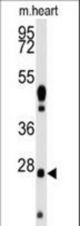 Western blot of anti-WDYHV1 Antibody antibody in mouse heart tissue lysates (35 ug/lane). WDYHV1(arrow) was detected using the purified antibody.