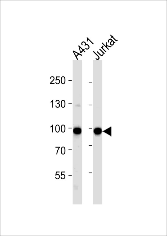 WEE1 Antibody (A159) western blot of A431, Jurkat cell line lysates (35 ug/lane). The WEE1 antibody detected the WEE1 protein (arrow).