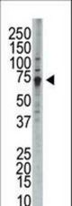 Western blot of anti-WEE1 antibody in HL-60 cell lysate. WEE1 (arrow) was detected using purified antibody. Secondary HRP-anti-rabbit was used for signal visualization with chemiluminescence.