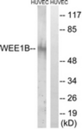 Western blot of extracts from HUVEC cells, using WEE2 Antibody. The lane on the right is treated with the synthesized peptide.