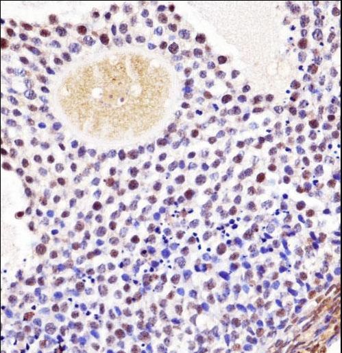 Mouse Wee2 Antibody immunohistochemistry of formalin-fixed and paraffin-embedded mouse ovarian tissue followed by peroxidase-conjugated secondary antibody and DAB staining.