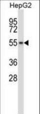 Mouse Wee2 Antibody western blot of HepG2 cell line lysates (35 ug/lane). The Wee2 antibody detected the Wee2 protein (arrow).