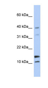 WFDC5 antibody LS-C111437 Western blot of Fetal Brain lysate.