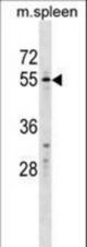 WFIKKN2 Antibody western blot of mouse spleen tissue lysates (35 ug/lane). The WFIKKN2 Antibody detected the WFIKKN2 protein (arrow).