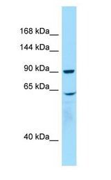 WHAMM antibody Western Blot of Placenta.