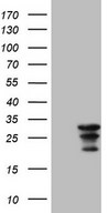 HEK293T cells were transfected with the pCMV6-ENTRY control (Left lane) or pCMV6-ENTRY WIBG (Right lane) cDNA for 48 hrs and lysed. Equivalent amounts of cell lysates (5 ug per lane) were separated by SDS-PAGE and immunoblotted with anti-WIBG.