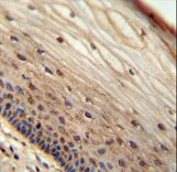 WIBG antibody immunohistochemistry of formalin-fixed and paraffin-embedded human cervical tissue followed by peroxidase-conjugated secondary antibody and DAB staining.