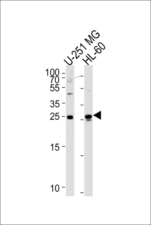 Western blot of lysates from U-251 MG, HL-60 cell line (from left to right), using WIBG Antibody. Antibody was diluted at 1:1000 at each lane. A goat anti-rabbit IgG H&L (HRP) at 1:5000 dilution was used as the secondary antibody. Lysates at 35ug per lane.