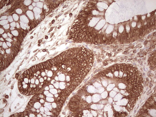 IHC of paraffin-embedded Human colon tissue using anti-WIBG mouse monoclonal antibody. (Heat-induced epitope retrieval by 1 mM EDTA in 10mM Tris, pH8.5, 120°C for 3min).