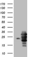 HEK293T cells were transfected with the pCMV6-ENTRY control (Left lane) or pCMV6-ENTRY WIBG (Right lane) cDNA for 48 hrs and lysed. Equivalent amounts of cell lysates (5 ug per lane) were separated by SDS-PAGE and immunoblotted with anti-WIBG.