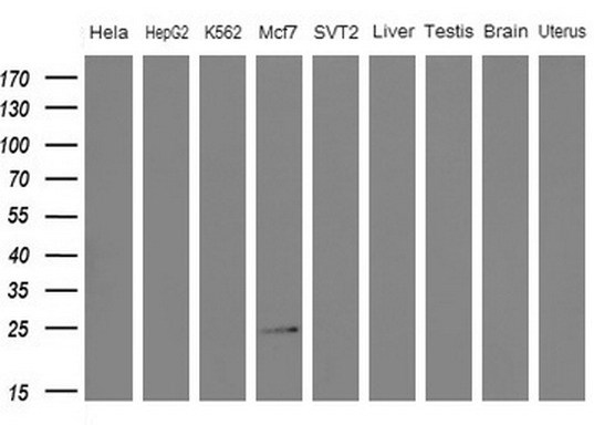 Western blot of extracts (10ug) from 5 different cell lines and 4 human tissue by using anti-WIBG monoclonal antibody (1: HeLa; 2: HepG2; 3: K562; 4: Mcf7; 5: SVT2; 6: Liver; 7: Testis; 8: Brain; 9: Uterus) at 1:200 dilution.