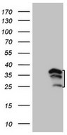 HEK293T cells were transfected with the pCMV6-ENTRY control (Left lane) or pCMV6-ENTRY WIBG (Right lane) cDNA for 48 hrs and lysed. Equivalent amounts of cell lysates (5 ug per lane) were separated by SDS-PAGE and immunoblotted with anti-WIBG.