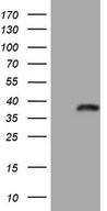 HEK293T cells were transfected with the pCMV6-ENTRY control (Left lane) or pCMV6-ENTRY WIBG (Right lane) cDNA for 48 hrs and lysed. Equivalent amounts of cell lysates (5 ug per lane) were separated by SDS-PAGE and immunoblotted with anti-WIBG.