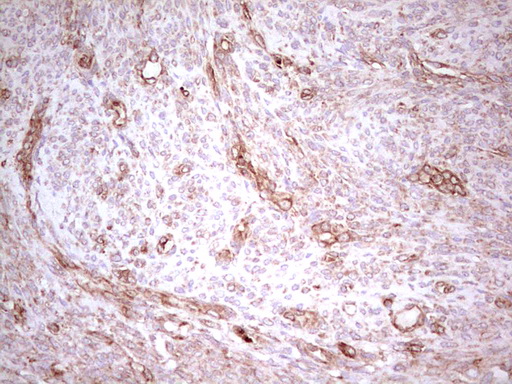 IHC of paraffin-embedded Human endometrium tissue using anti-WIBG mouse monoclonal antibody. (Heat-induced epitope retrieval by 1 mM EDTA in 10mM Tris, pH8.5, 120°C for 3min).