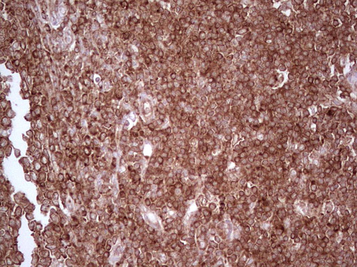 IHC of paraffin-embedded Human tonsil using anti-WIBG mouse monoclonal antibody. (Heat-induced epitope retrieval by 1 mM EDTA in 10mM Tris, pH8.5, 120°C for 3min).