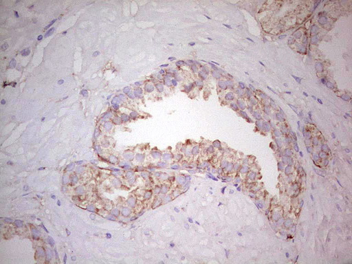 IHC of paraffin-embedded Human prostate tissue using anti-WIBG mouse monoclonal antibody. (Heat-induced epitope retrieval by 1 mM EDTA in 10mM Tris, pH8.5, 120°C for 3min).