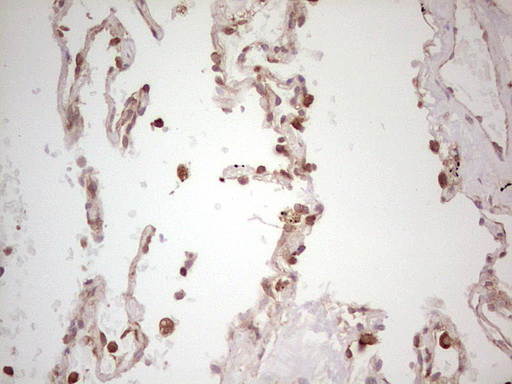 IHC of paraffin-embedded Human lung tissue using anti-WIBG mouse monoclonal antibody. (Heat-induced epitope retrieval by 1 mM EDTA in 10mM Tris, pH8.5, 120°C for 3min).