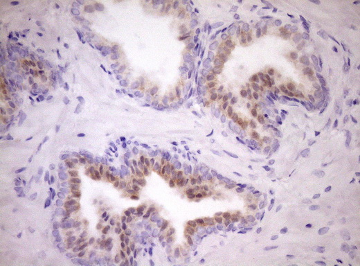 IHC of paraffin-embedded Human prostate tissue using anti-WIBG mouse monoclonal antibody. (Heat-induced epitope retrieval by Tris-EDTA, pH8.0)(1:150).