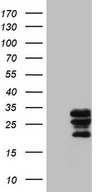 HEK293T cells were transfected with the pCMV6-ENTRY control (Left lane) or pCMV6-ENTRY WIBG (Right lane) cDNA for 48 hrs and lysed. Equivalent amounts of cell lysates (5 ug per lane) were separated by SDS-PAGE and immunoblotted with anti-WIBG (1:2000).
