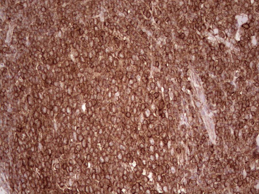 IHC of paraffin-embedded Human tonsil using anti-WIBG mouse monoclonal antibody. (Heat-induced epitope retrieval by 1 mM EDTA in 10mM Tris, pH8.5, 120°C for 3min).