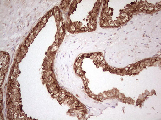 IHC of paraffin-embedded Human prostate tissue using anti-WIBG mouse monoclonal antibody. (Heat-induced epitope retrieval by 1 mM EDTA in 10mM Tris, pH8.5, 120°C for 3min).